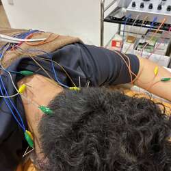 慢性的な頭痛の悩みに鍼灸