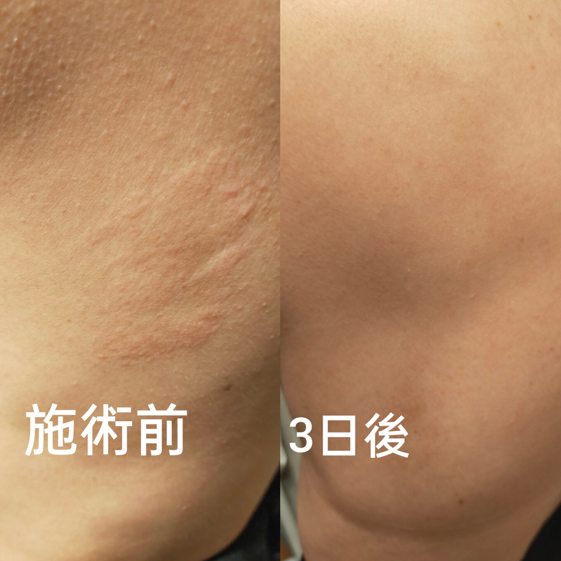 40代　女性